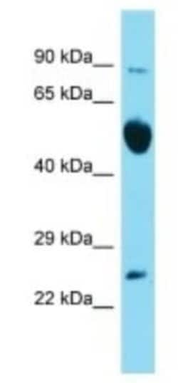 RAB6B Rabbit anti-Mouse, Polyclonal, Novus Biologicals 100 &mu;g; Unconjugated:Antibodies,